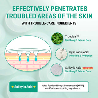 SOME BY MI Micro Pin Spot Patch Bundle Sæt, 9 patches x 5 stk