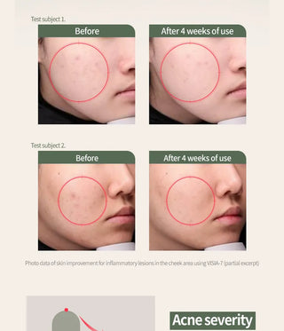 FRUDIA What's Wrong Help AC Clear Pad, 50 stk