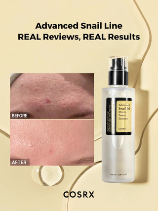 COSRX - Advanced Snail 96 Mucin Power Essence, 100 ml