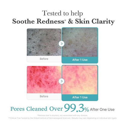 Azelaic Acid Niacinamide Deep Clean Foam Cleanser