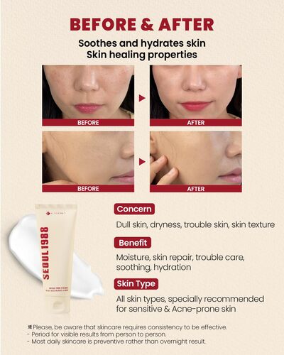 Cream: Retinal Liposome 1% + Fermented Rice
