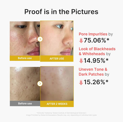 Kojic Acid Turmeric Peel Shot