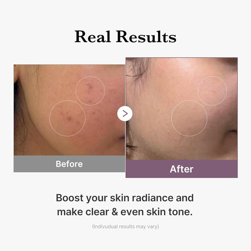 AGE-R Glutathione Glow Toner