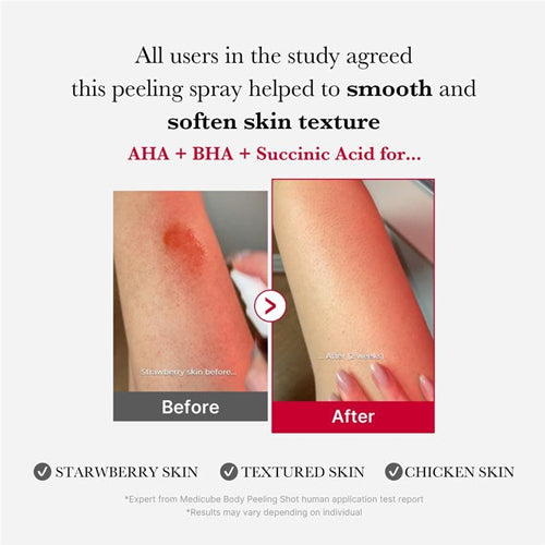 Red Acne Body Peeling Shot 2.0