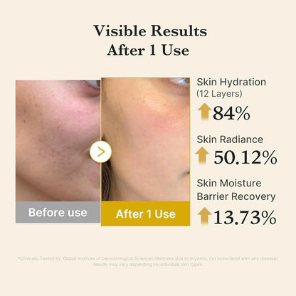 TERMERIC Kojic Acid Turmeric Vita Jelly Mist Serum