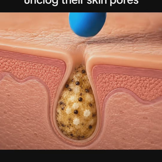 Well this was something to try with the medicube zero pore blackhead mud mask #medicube #mudmask #koreanskincare #kbeauty #skincare disclaimer: individual results may vary 