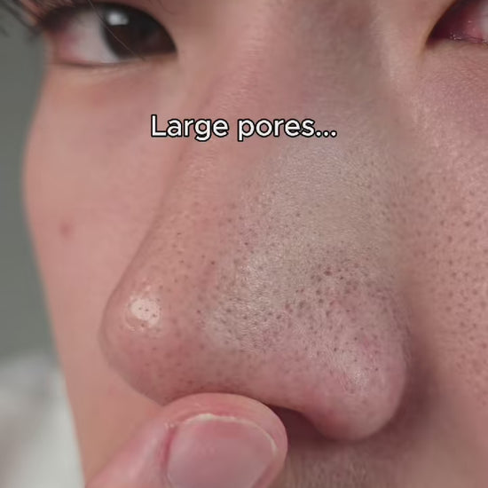 YOU NEED RETINAL #retinal #retinalshot #celimax #kbeauty #skincare @celimax.global 
