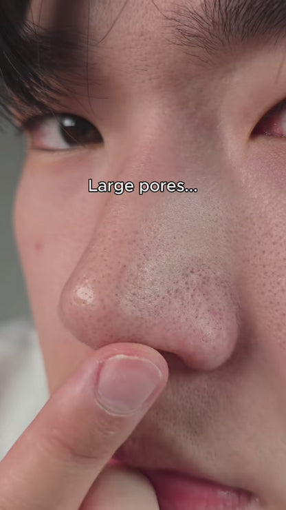 YOU NEED RETINAL #retinal #retinalshot #celimax #kbeauty #skincare @celimax.global 