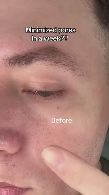 Seoul 1988 Serum: Retinal Liposome 2% + Black Ginseng, 30 ml