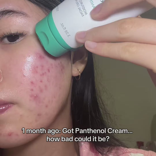Yesstyle Code: LUVKAT13 Best acne moisturiser: Purito Mighty Bamboo Panthenol Cream #purito #acnetreatment #panthenolcream #realpostacnecream #realpostacnecreamchallenge @PURITO SEOUL 
