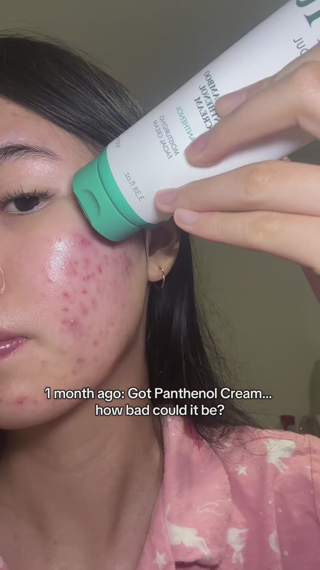Yesstyle Code: LUVKAT13 Best acne moisturiser: Purito Mighty Bamboo Panthenol Cream #purito #acnetreatment #panthenolcream #realpostacnecream #realpostacnecreamchallenge @PURITO SEOUL 
